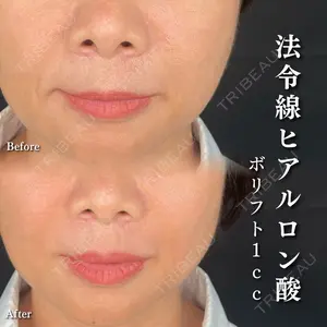 ルラ美容クリニック 千葉院 奥田 弘也医師の症例