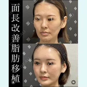 EMMO FACE CLINIC 大宮院 廣松 直樹医師の症例