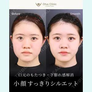 Otus Clinic 【オータスクリニック】 中 徳太郎医師の症例