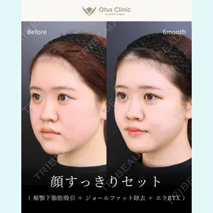 Otus Clinic 【オータスクリニック】 中 徳太郎医師の症例