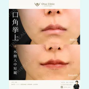 Otus Clinic 【オータスクリニック】 中 徳太郎医師の症例