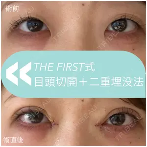 THE FIRST CLINIC 多摩センター院 惟村 公郁医師の症例