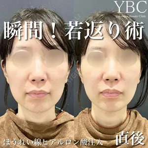 YBC横浜美容外科 大宮院 磯村 亮輔医師の症例