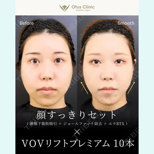 Otus Clinic 【オータスクリニック】 中 徳太郎医師の症例