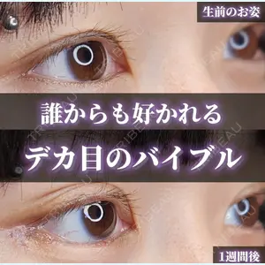 Tokyo Tensei Clinic 新宿院 沖津 勇気（ブレイブ沖津）医師の症例