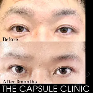 THE CAPSULE CLINIC（ザ カプセルクリニック） 木塚 雄一郎医師の症例