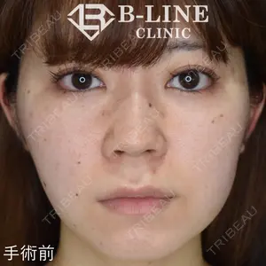 B-LINE CLINIC 池袋院 小池 康弘医師の症例