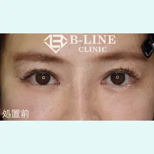 B-LINE CLINIC 池袋院 小池 康弘医師の症例