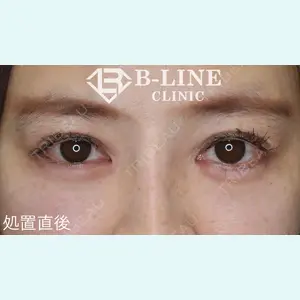 B-LINE CLINIC 池袋院 小池 康弘医師の症例