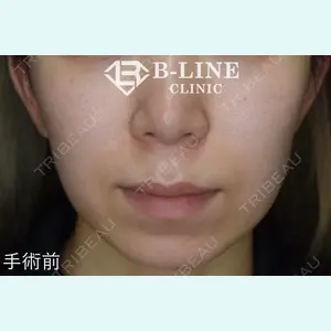 B-LINE CLINIC 池袋院 小池 康弘医師の症例