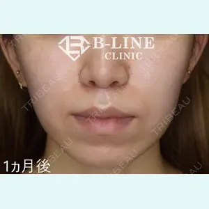 B-LINE CLINIC 池袋院 小池 康弘医師の症例