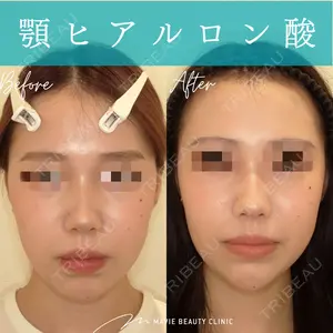 Mavie Beauty Clinic （マヴィービューティークリニック） 渡邉 憲一郎医師の症例