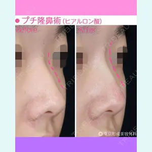 東京形成美容外科 船橋院 弓削田　浩主医師の症例