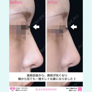 東京形成美容外科 船橋院 弓削田　浩主医師の症例