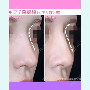東京形成美容外科 船橋院 弓削田　浩主医師の症例