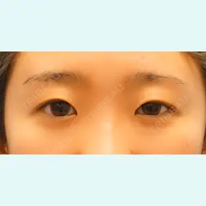 麹町皮ふ科・形成外科クリニックの症例