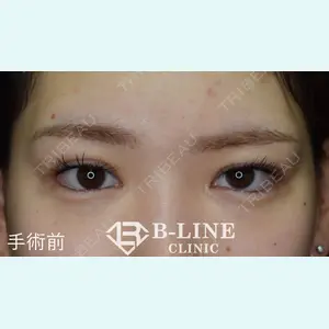 B-LINE CLINIC 池袋院 小池 康弘医師の症例