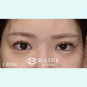 B-LINE CLINIC 池袋院 小池 康弘医師の症例