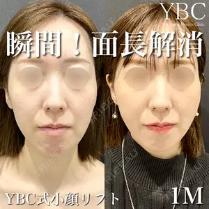 YBC横浜美容外科 大宮院 磯村 亮輔医師の症例