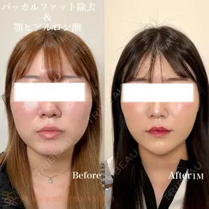 SK新宿歌舞伎町美容外科・歯科の症例