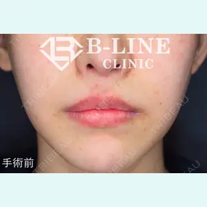 B-LINE CLINIC 池袋院 小池 康弘医師の症例