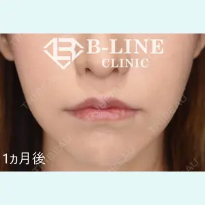 B-LINE CLINIC 池袋院 小池 康弘医師の症例