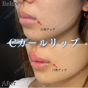 ルラ美容クリニック 札幌院の症例