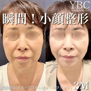 YBC横浜美容外科 大宮院の症例