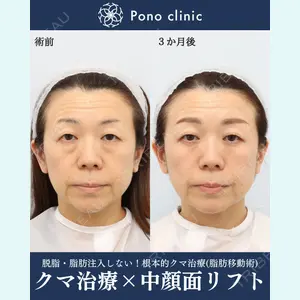 Pono clinic 【ポノクリ】 芝 容平医師の症例
