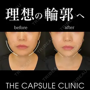 THE CAPSULE CLINIC（ザ カプセルクリニック） 木塚 雄一郎医師の症例