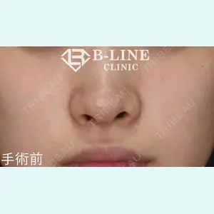 B-LINE CLINIC 池袋院 小池 康弘医師の症例