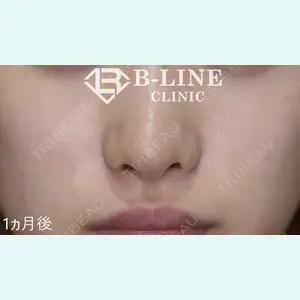 B-LINE CLINIC 池袋院 小池 康弘医師の症例