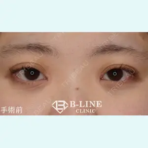 B-LINE CLINIC 池袋院 小池 康弘医師の症例