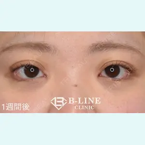 B-LINE CLINIC 池袋院 小池 康弘医師の症例