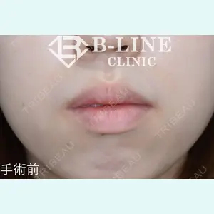 B-LINE CLINIC 池袋院 小池 康弘医師の症例