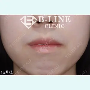 B-LINE CLINIC 池袋院 小池 康弘医師の症例