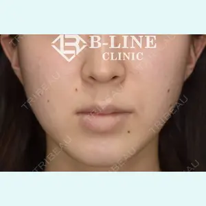 B-LINE CLINIC 池袋院 小池 康弘医師の症例