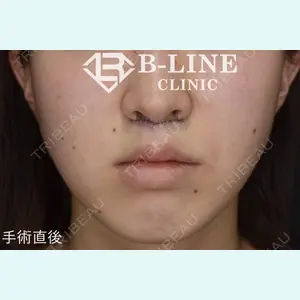 B-LINE CLINIC 池袋院 小池 康弘医師の症例