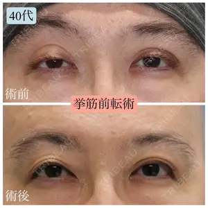 お茶の水美容形成クリニックの症例