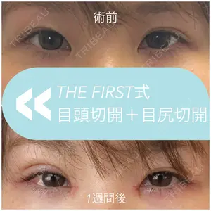 THE FIRST CLINIC 多摩センター院 惟村 公郁医師の症例