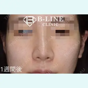 B-LINE CLINIC 池袋院 小池 康弘医師の症例