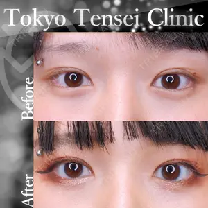 Tokyo Tensei Clinic 新宿院 沖津 勇気（ブレイブ沖津）医師の症例