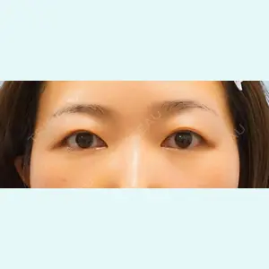 麹町皮ふ科・形成外科クリニックの症例