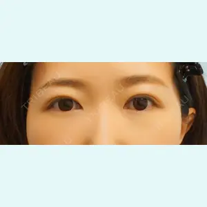 麹町皮ふ科・形成外科クリニックの症例