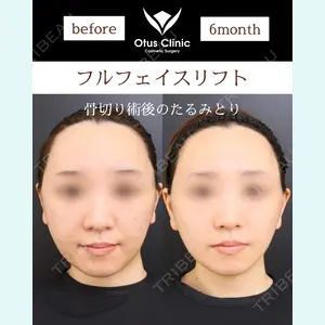 Otus Clinic 【オータスクリニック】 中 徳太郎医師の症例