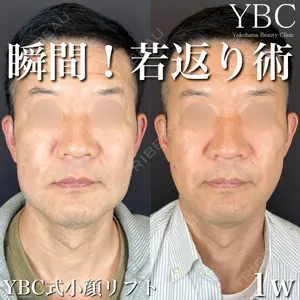 YBC横浜美容外科 大宮院 磯村 亮輔医師の症例