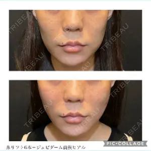 DMTC美容皮膚科 日本橋院 山中大介医師の症例