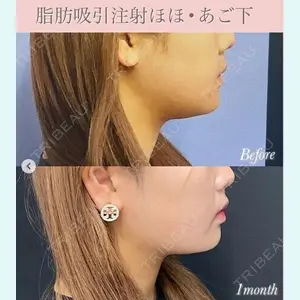 湘南美容クリニック 秋葉原院の症例