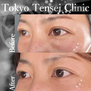 Tokyo Tensei Clinic 新宿院 辻 大成医師の症例