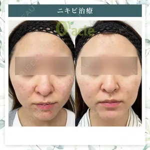 オラクル美容皮膚科 名古屋院の症例